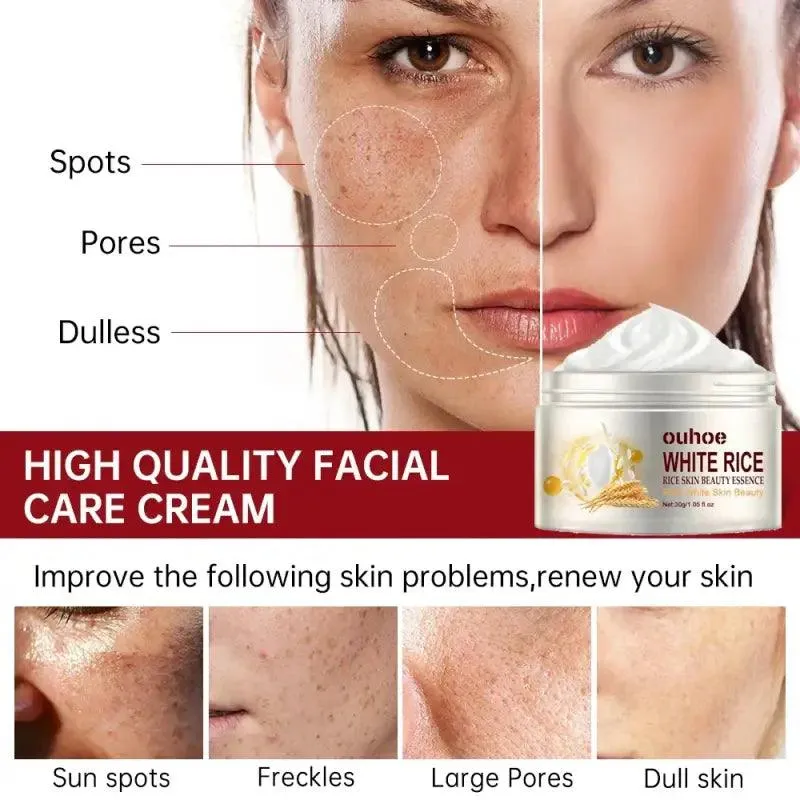 White Rice Whitening Face Cream: Removes Dark Spots, Anti-wrinkle